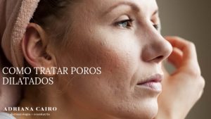 Read more about the article Tratamento para poros dilatados