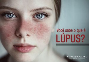 Read more about the article Perguntas e respostas sobre Lúpus